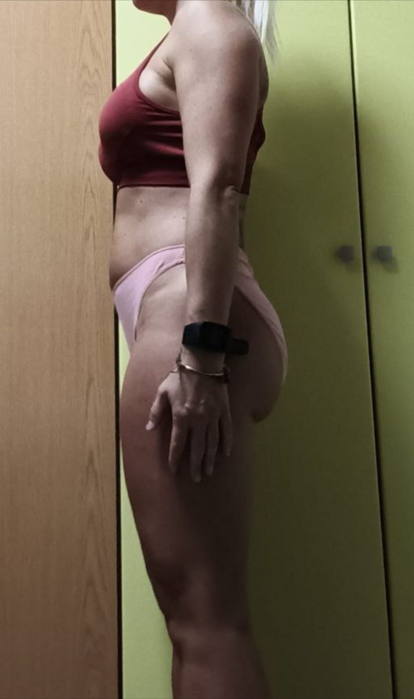 Antes