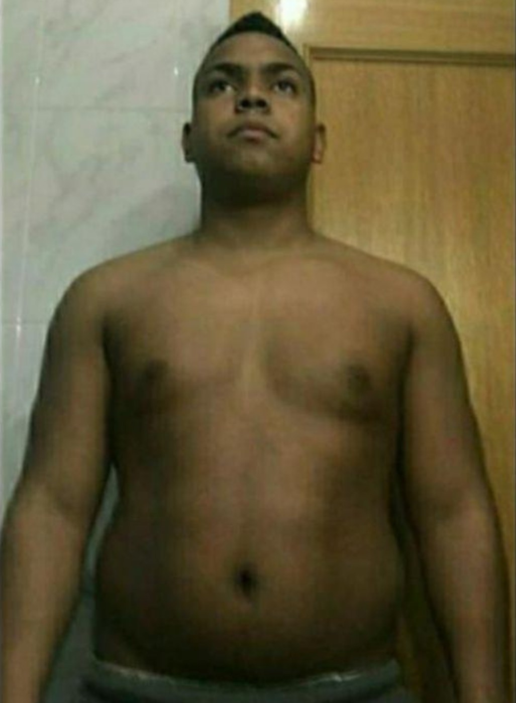 Antes